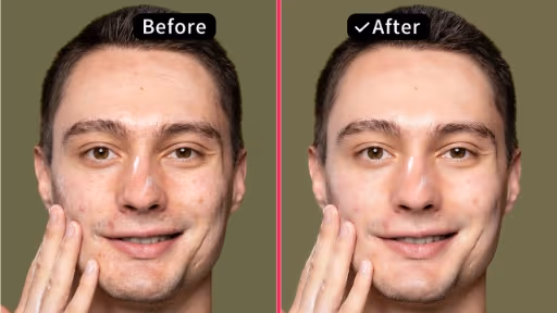 Face Beauty Advanced